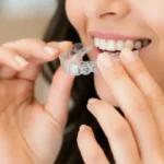 Dentální hygiena s neviditelnými rovnátky. Jak na ni?