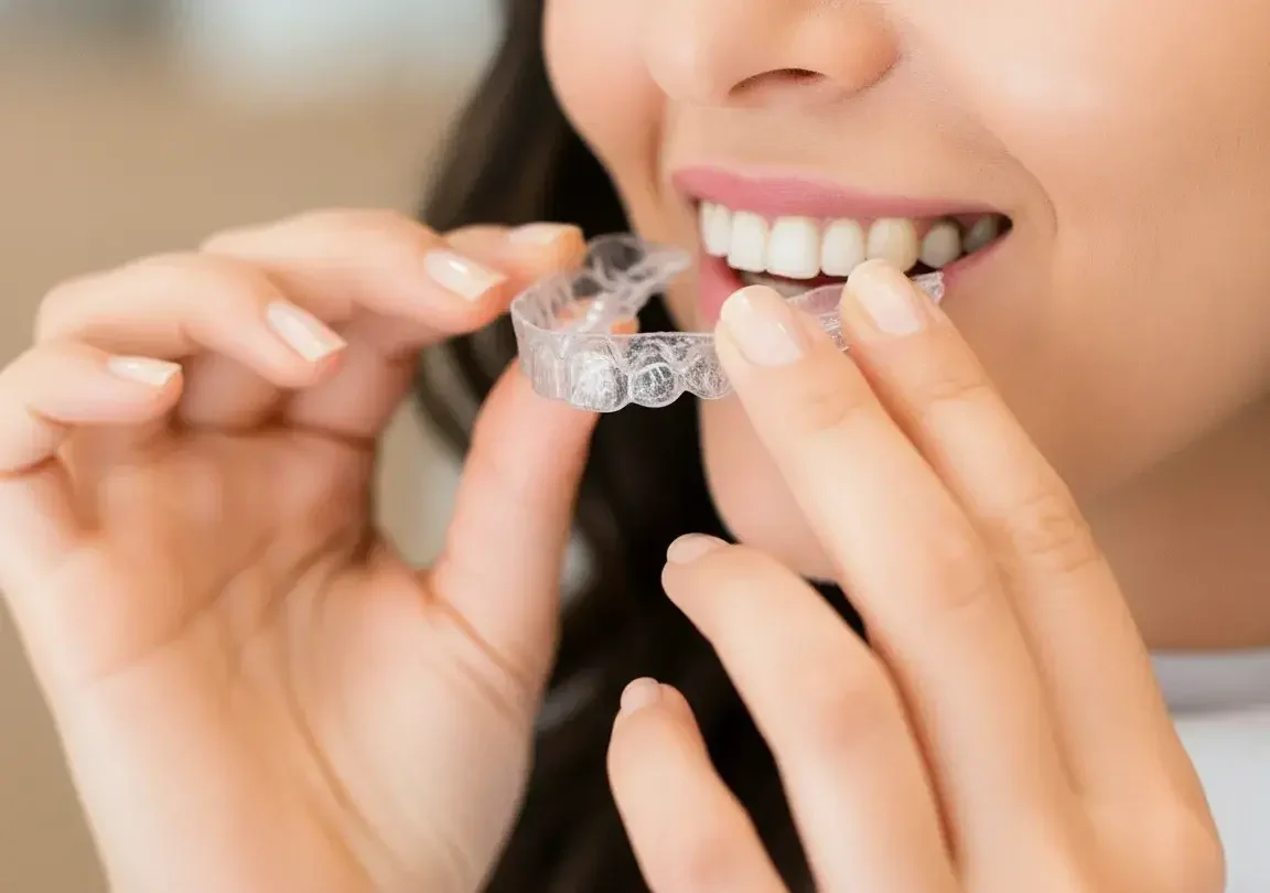 Přečtete si více ze článku Dentální hygiena s neviditelnými rovnátky. Jak na ni?